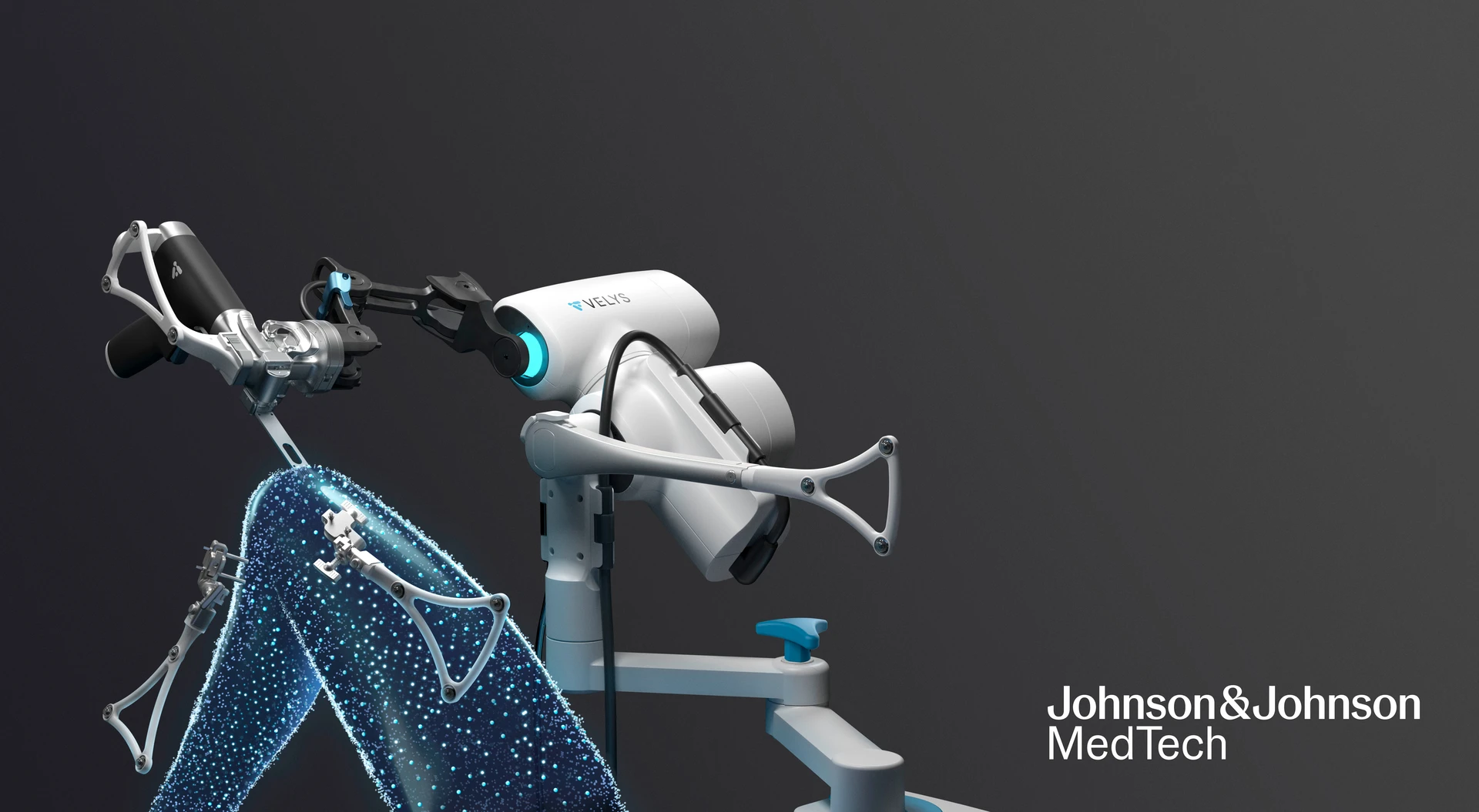 VELYS Robotic-Assisted Solution: Digital Precision in Knee Replacement Surgery | DePuy Synthes